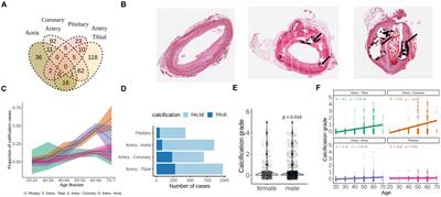 Comparative analysis of calcified soft tissues revealed shared deregulated pathways